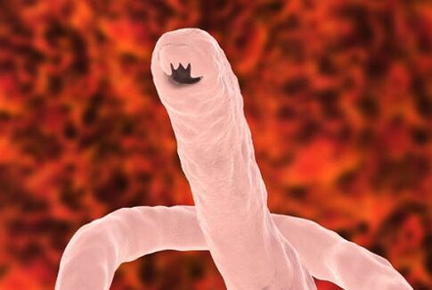 ľudský parazit červ