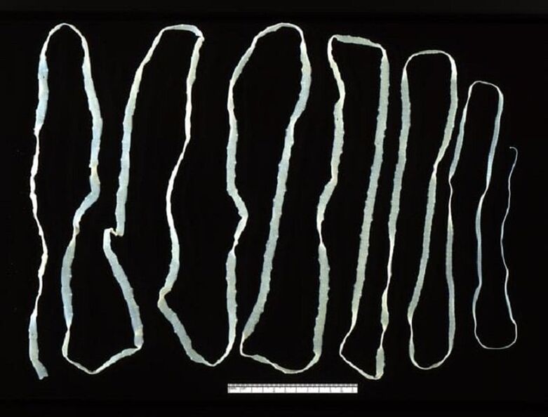 Pásomnica extrahovaná z ľudského čreva