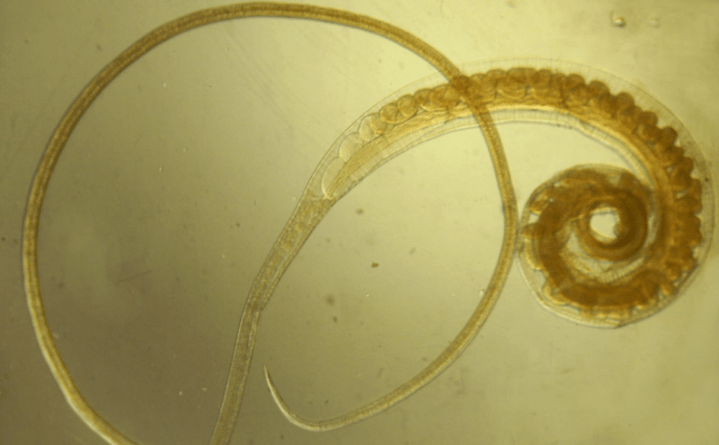 Ľudský whipworm - helmint, ktorý postihuje dospievajúcich