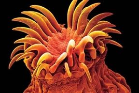 Parazity trematódy u ľudí