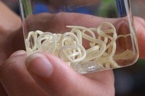 parazitov z ľudského tela