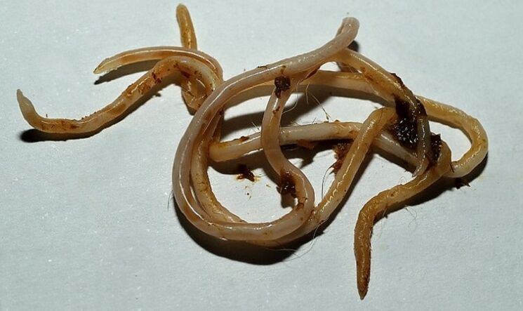 toxocara z ľudského tela